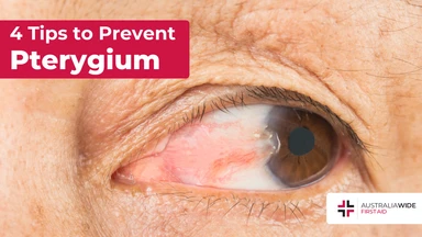 Prevent pterygium article header – First Aid Article in Canning Vale